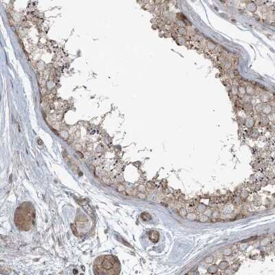 Immunohistochemistry-Paraffin: PIK3R4 Antibody [NBP2-38276]
