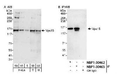 Western Blot: PIK3R4 Antibody [NBP1-30463]