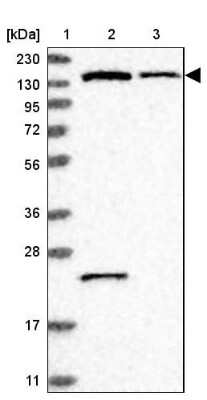 Western Blot: PIK3R4 Antibody [NBP1-82451]