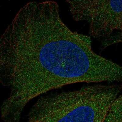 Immunocytochemistry/ Immunofluorescence: PIK3R5 Antibody [NBP2-57055]