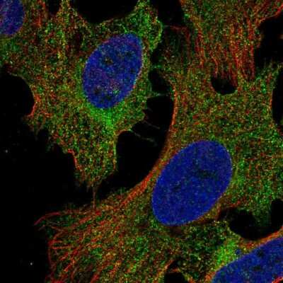 Immunocytochemistry/ Immunofluorescence: PIK3R5 Antibody [NBP2-58521]