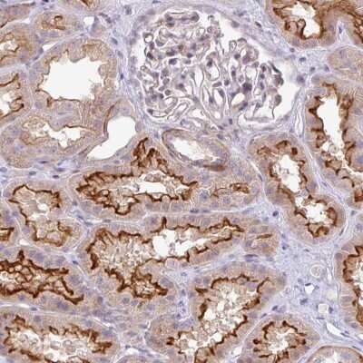 Immunohistochemistry: PIK3R5 Antibody [NBP2-49037]