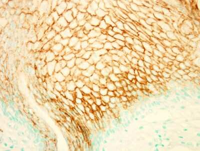 Immunohistochemistry-Paraffin: PIK3R5 Antibody [NBP2-19830]