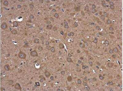 Immunohistochemistry-Paraffin: PIK3R5 Antibody [NBP2-19830]