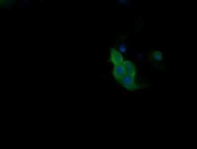 Immunocytochemistry/ Immunofluorescence: PIK3R5 Antibody (OTI4G9) - Azide and BSA Free [NBP2-73408]