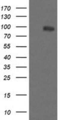 Western Blot: PIK3R5 Antibody (OTI4G9)Azide and BSA Free [NBP2-73408]