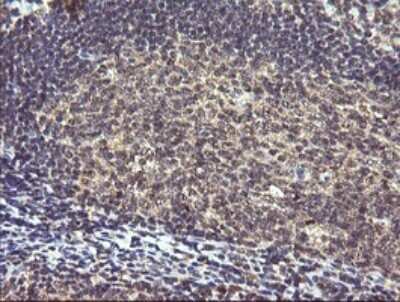 Immunohistochemistry: PIK3R5 Antibody (OTI4G9) [NBP2-46413]