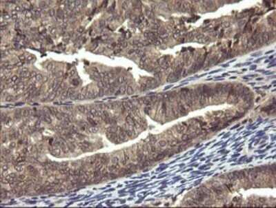 Immunohistochemistry: PIK3R5 Antibody (OTI4G9) [NBP2-46413]