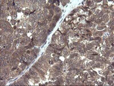 Immunohistochemistry: PIK3R5 Antibody (OTI4G9) [NBP2-46413]