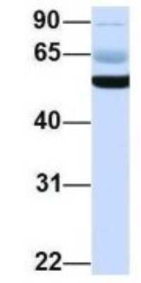 Western Blot: PIK3R5 Antibody [NBP1-56922]