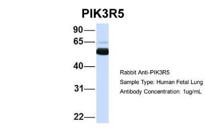 Western Blot: PIK3R5 Antibody [NBP1-56922]