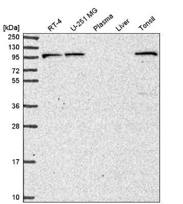 Western Blot: PIK3R5 Antibody [NBP2-57055]