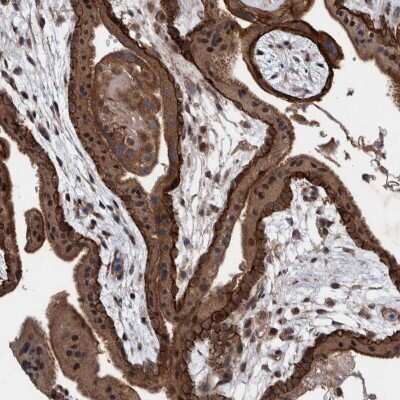 Immunohistochemistry-Paraffin: PIK3R6 Antibody [NBP2-48560]