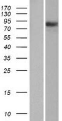 Western Blot: PIK3R6 Overexpression Lysate [NBP2-08762]