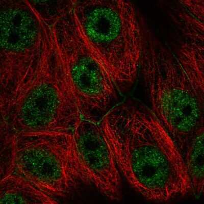 Immunocytochemistry/ Immunofluorescence: PIK4CA Antibody [NBP2-57995]