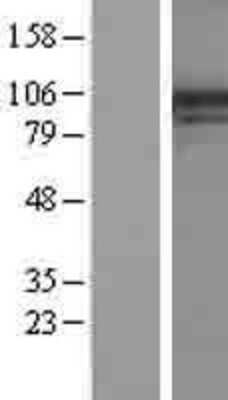 Western Blot: PIK4CA Overexpression Lysate [NBL1-14382]