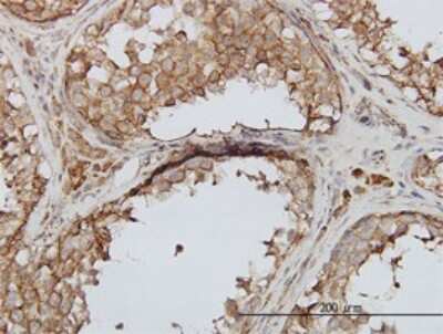 Immunohistochemistry-Paraffin: PIKFyve/PIP5K3 Antibody (6C7) [H00200576-M01]