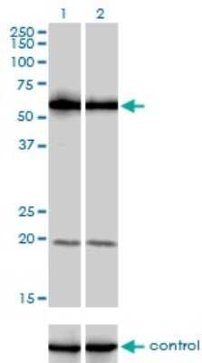 Western Blot: PIKFyve/PIP5K3 Antibody (6C7) [H00200576-M01]