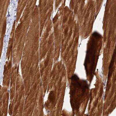 Immunohistochemistry: PIKFyve/PIP5K3 Antibody [NBP1-89613]