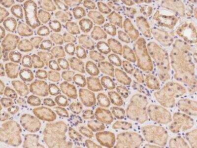 Immunohistochemistry-Paraffin: PIKFyve/PIP5K3 Antibody [NBP3-12608]