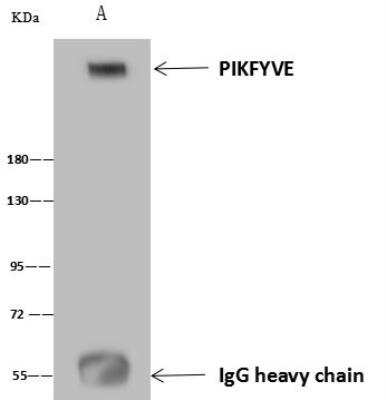 Immunoprecipitation: PIKFyve/PIP5K3 Antibody [NBP3-12608]