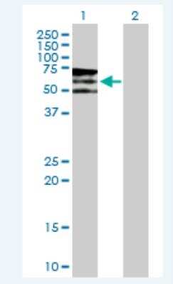 Western Blot: PIKFyve/PIP5K3 Antibody [H00200576-B02P-50ug]