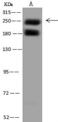 Western Blot: PIKFyve/PIP5K3 Antibody [NBP3-12608]