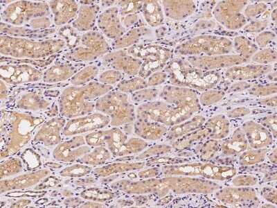 Immunohistochemistry-Paraffin: PILR-beta Antibody [NBP2-98648]