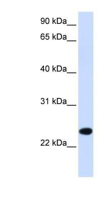 Western Blot: PILR-beta Antibody [NBP1-62359]