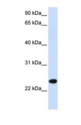 Western Blot: PILR-beta Antibody [NBP1-69382]