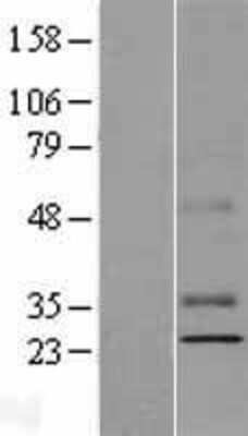 Western Blot: PILR-beta Overexpression Lysate [NBP2-10041]