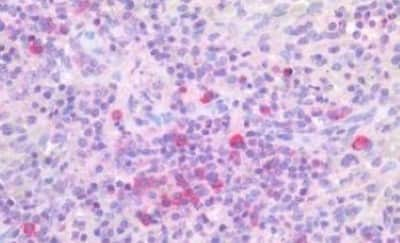 Immunohistochemistry-Paraffin: PIM1 Antibody [NBP3-14445]