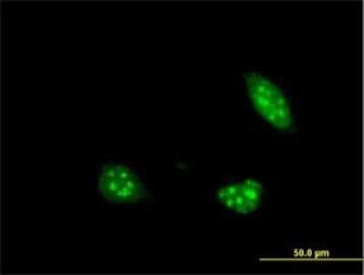 Immunocytochemistry/ Immunofluorescence: PIM1 Antibody (2C8) [H00005292-M02]