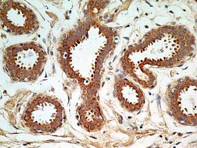 Immunohistochemistry-Paraffin: PIM1 Antibody [NBP2-31366]