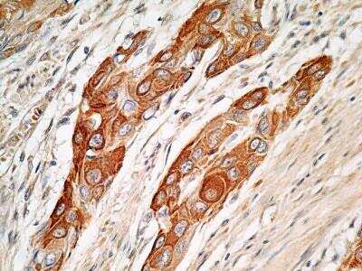 Immunohistochemistry-Paraffin: PIM1 Antibody [NBP2-31366]