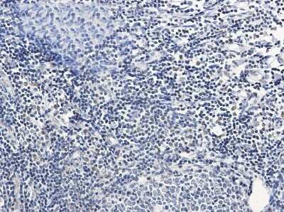 Immunohistochemistry-Paraffin: PIM1 Antibody (S08-8D5) [NBP3-14963]