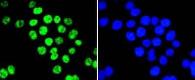 Immunocytochemistry/ Immunofluorescence: PIM1 Antibody (ST0513) [NBP2-67528]