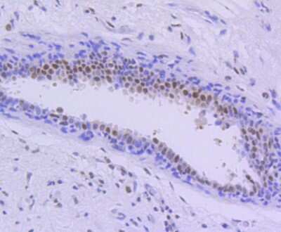 Immunohistochemistry-Paraffin: PIM1 Antibody (ST0513) [NBP2-67528]