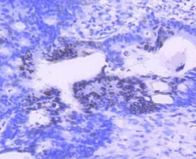 Immunohistochemistry-Paraffin: PIM1 Antibody (ST0513) [NBP2-67528]