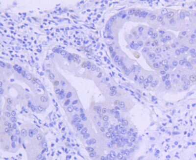 Immunohistochemistry-Paraffin: PIM1 Antibody (ST0513) [NBP2-67528]