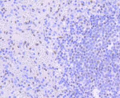Immunohistochemistry-Paraffin: PIM1 Antibody (ST0513) [NBP2-67528]