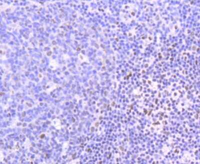 Immunohistochemistry-Paraffin: PIM1 Antibody (ST0513) [NBP2-67528]