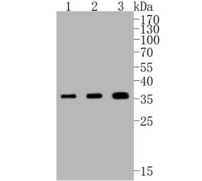 Western Blot: PIM1 Antibody (ST0513) [NBP2-67528]