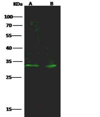 Western Blot: PIM1 Antibody [NBP3-12778]