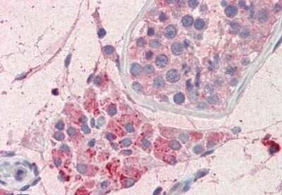 Immunohistochemistry-Paraffin: PIM2 Antibody [NBP2-26114]