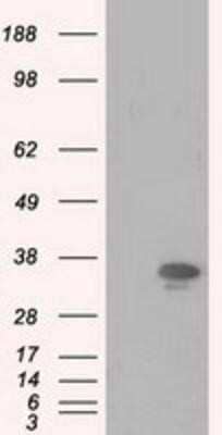 Western Blot: PIM2 Antibody (OTI5D5)Azide and BSA Free [NBP2-73412]