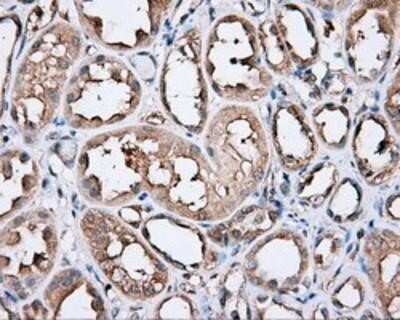 Immunohistochemistry-Paraffin: PIM2 Antibody (OTI5D5) [NBP2-02441]