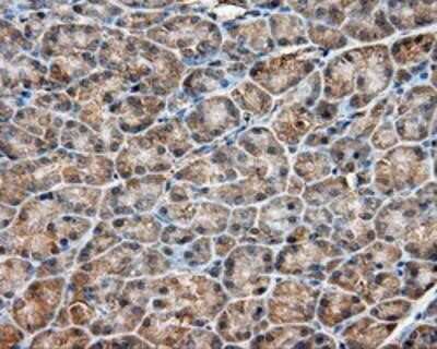 Immunohistochemistry-Paraffin: PIM2 Antibody (OTI5D5) [NBP2-02441]
