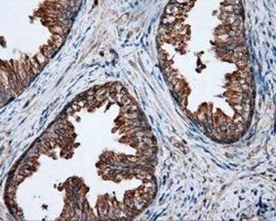 Immunohistochemistry-Paraffin: PIM2 Antibody (OTI5D5) [NBP2-02441]