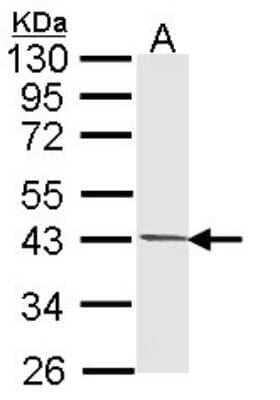 Western Blot: PIM2 Antibody [NBP1-33731]